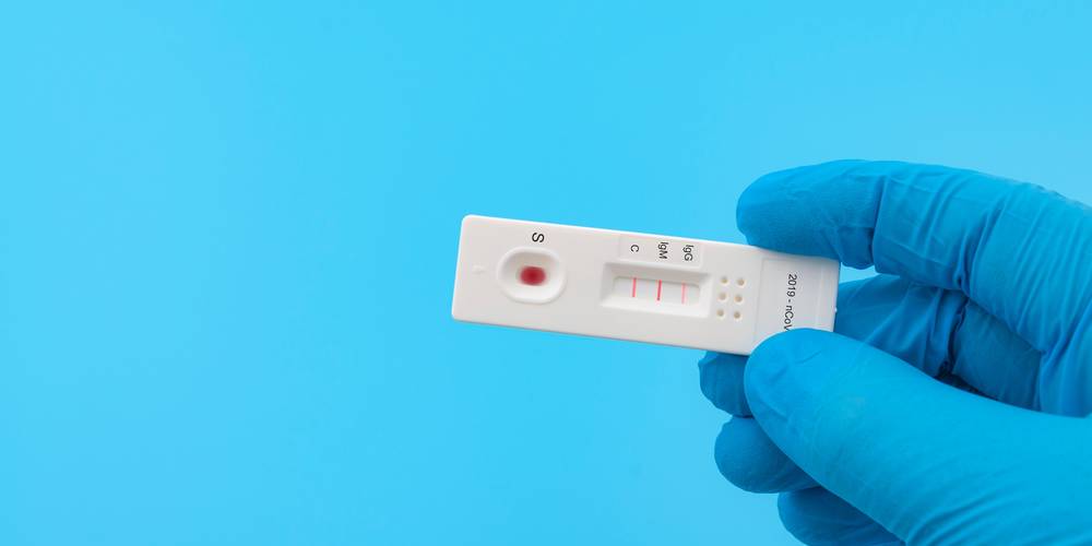 Aktien zu Virologische Diagnostik
