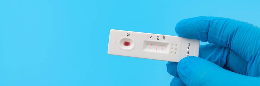 Aktien zu Virologische Diagnostik